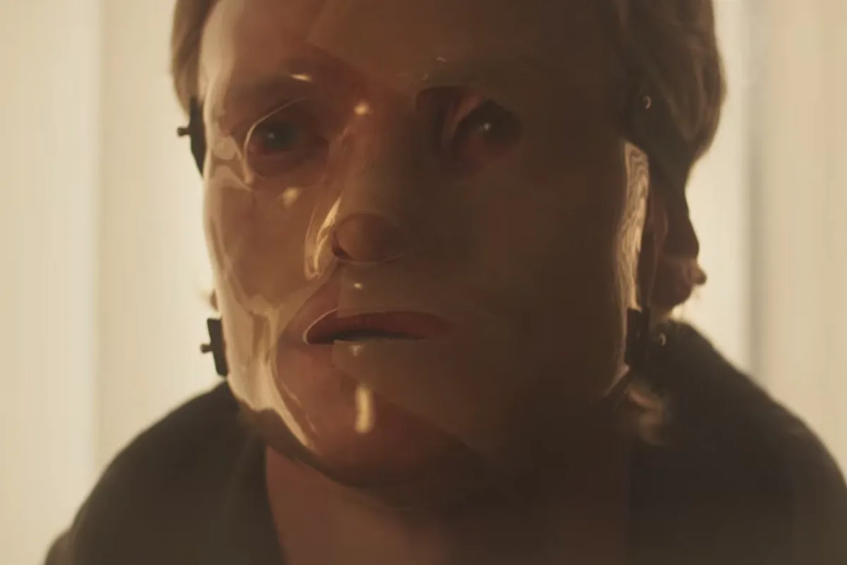 Matt Hagen wearing a clear, rigid medical mask over his scarred face